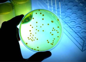 Microbiological Testing lab Near me, Ghaziabad, UP, Delhi, Gurgaon, Noida, Jaipur (2)